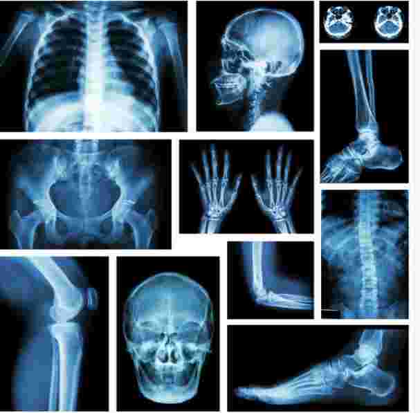 MEDICAL IMAGING